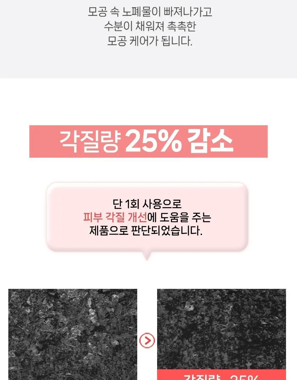 [여드름기능성/약알칼리성] 아토뮤 아크리스 폼클렌저 120ml 상세페이지 23